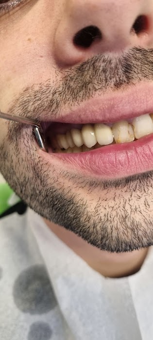 NP Dental Clinic - Зъболекар София, Детски зъболекар София, Ортодонт София