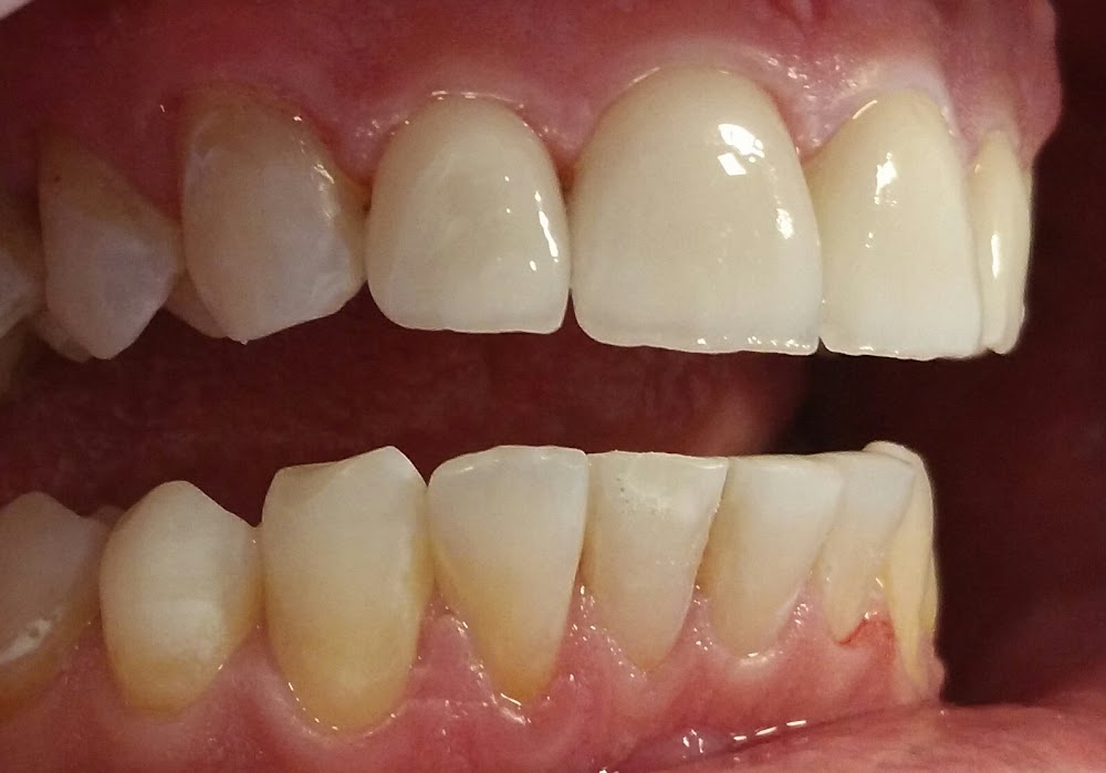 Dental Holistic Center Vedra Dental