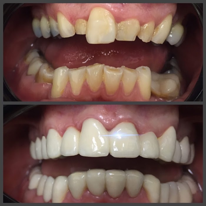 Dental Tourism in Bulgaria
