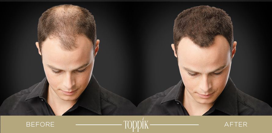 Toppik България