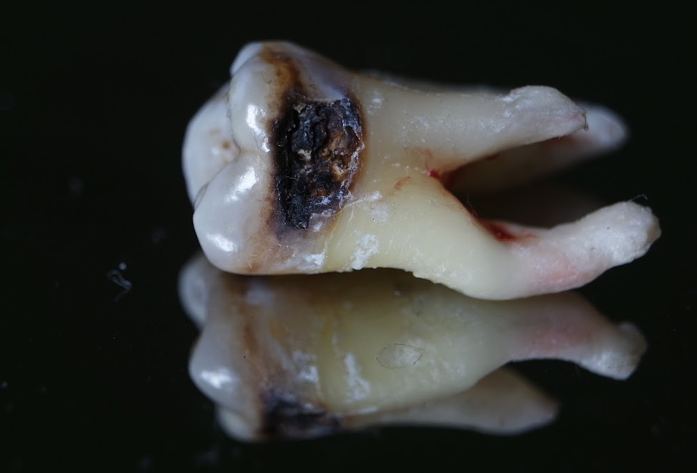 AZdent (dr. Adem/ dr. Zongova)