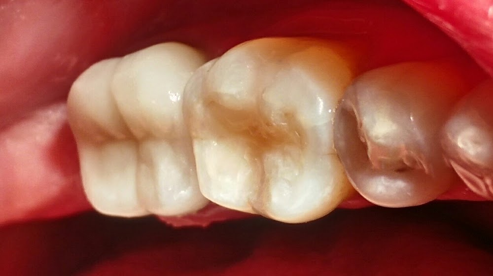 Dental Holistic Center Vedra Dental