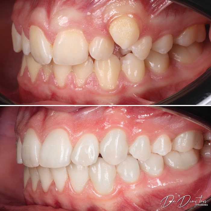 Д-р Димитър Димитров - Ортодонтия/ Dr. Dimitar Dimitrov - Stankov Dental